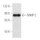 MMP2 Antibody (2C1) - Western Blotting - Image 3842