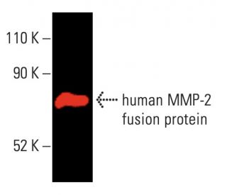 MMP2 Antibody (8B4) - Western Blotting - Image 403740 