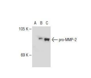 western blotting image from recommended MMP2 (2C1) monoclonal antibody replacement. Image 109916