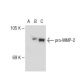 This polyclonal antibody has been discontinued. See our recommended <a href="mmp-2-antibody-2c1">MMP2 (2C1)</a> monoclonal antibody (sample data shown). western blotting image from recommended MMP2 (2C1) monoclonal antibody replacement. Image 109916