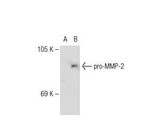 MMP-2 (2C1): sc-13594. Western blot analysis of MMP-2 expression in...