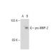MMP-2 (2C1): sc-13594. Western blot analysis of MMP-2 expression in...