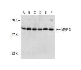 western blotting image from recommended MMP-3 (1B4) monoclonal antibody replacement. Image 141328