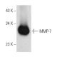 This polyclonal antibody has been discontinued. See our recommended <a href="mmp-7-antibody-a-5">MMP-7 (A-5)</a> monoclonal antibody (sample data shown). western blotting image from recommended MMP-7 (A-5) monoclonal antibody replacement. Image 389128