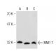 MMP-7 Antibody (JL07) - Western Blotting - Image 147324