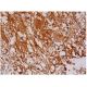 MMP9 Antibody (6-6B) - Immunohistochemistry - Image 286326