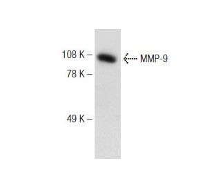 MMP9 Antibody (7-11C) - Western Blotting - Image 148928 