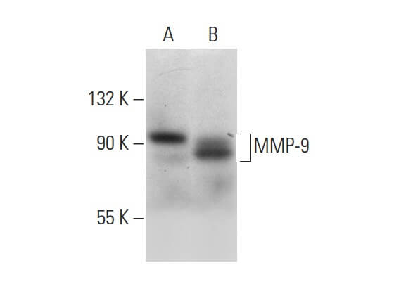 ゆどうふ mmp-9-antibody-e-11-western-