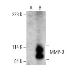 MMP-9 (E-11) HRP: sc-393859 HRP. Direct western blot analysis... 