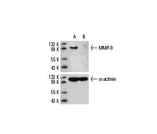 MMP-9 siRNA (h): sc-29400. Western blot analysis of MMP-9 expression in non-transfected control (A) and MMP-9 siRNA transf 