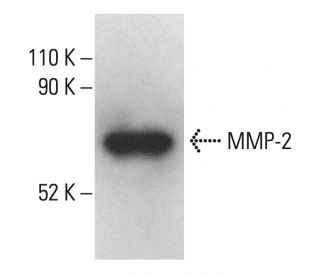 MMP2 Antibody (4D3) - Western Blotting - Image 401919