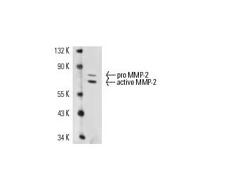 MMP2 Antibody (4D3) - Western Blotting - Image 14959