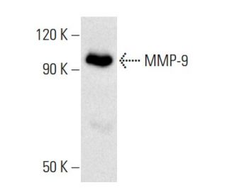 MMP9 Antibody (6-6B) - Western Blotting - Image 3855