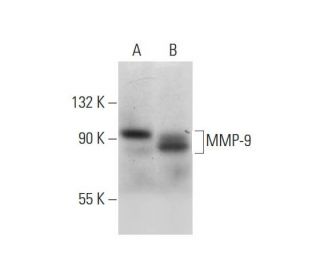 MMP9 Antibody (E-11) - Western Blotting - Image 299172Each CRISPR/Cas9 Knockout (KO) Plasmid product consists of a pool of 3 plasmids designed to ensure identification and cleavage of a specific gene for maximum knockout efficiency. Each plasmid encodes a unique 20 nt sequence derived from the GeCKO (v2) library.