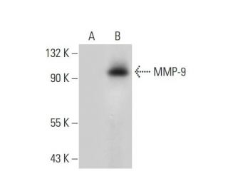 MMP9 Antibody (E-11) - Western Blotting - Image 299174