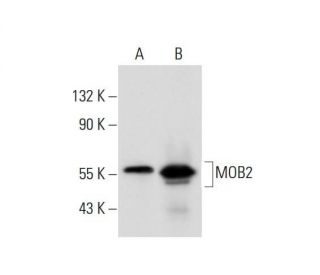 MOB2 Antibody (2400C3a) - Western Blotting - Image 318170Each CRISPR/Cas9 Knockout (KO) Plasmid product consists of a pool of 3 plasmids designed to ensure identification and cleavage of a specific gene for maximum knockout efficiency. Each plasmid encodes a unique 20 nt sequence derived from the GeCKO (v2) library.