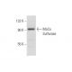 MoCo Sulfurase Antibody (D-6) - Western Blotting - Image 301524 