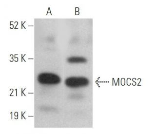 MOCS2 Antibody (F-9) - Western Blotting - Image 369417 