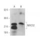 MOCS2 Antibody (G-9) - Western Blotting - Image 369418 