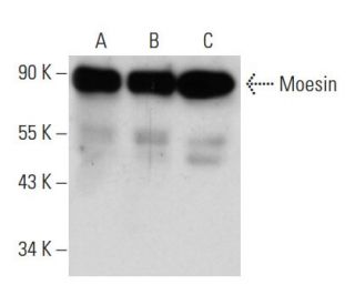 Moesin Antibody (38/87) - Western Blotting - Image 14801 