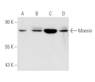 western blotting image from recommended Moesin (E-10) monoclonal antibody replacement. Image 3441