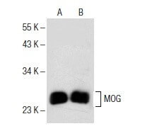 mog antibody testing order