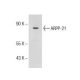 ARPP-21 (E-13): sc-102327. Western blot analysis of ARPP-21 expression in MOLT-4 whole cell lysate.