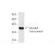 MondoA Antibody (5F3) - Western Blotting - Image 349527