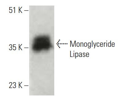 protein lipase c Monoglyceride Antibody (C-11) | SCBT A Houston compounding pharmacy InStock Flavour:Juicy Orange