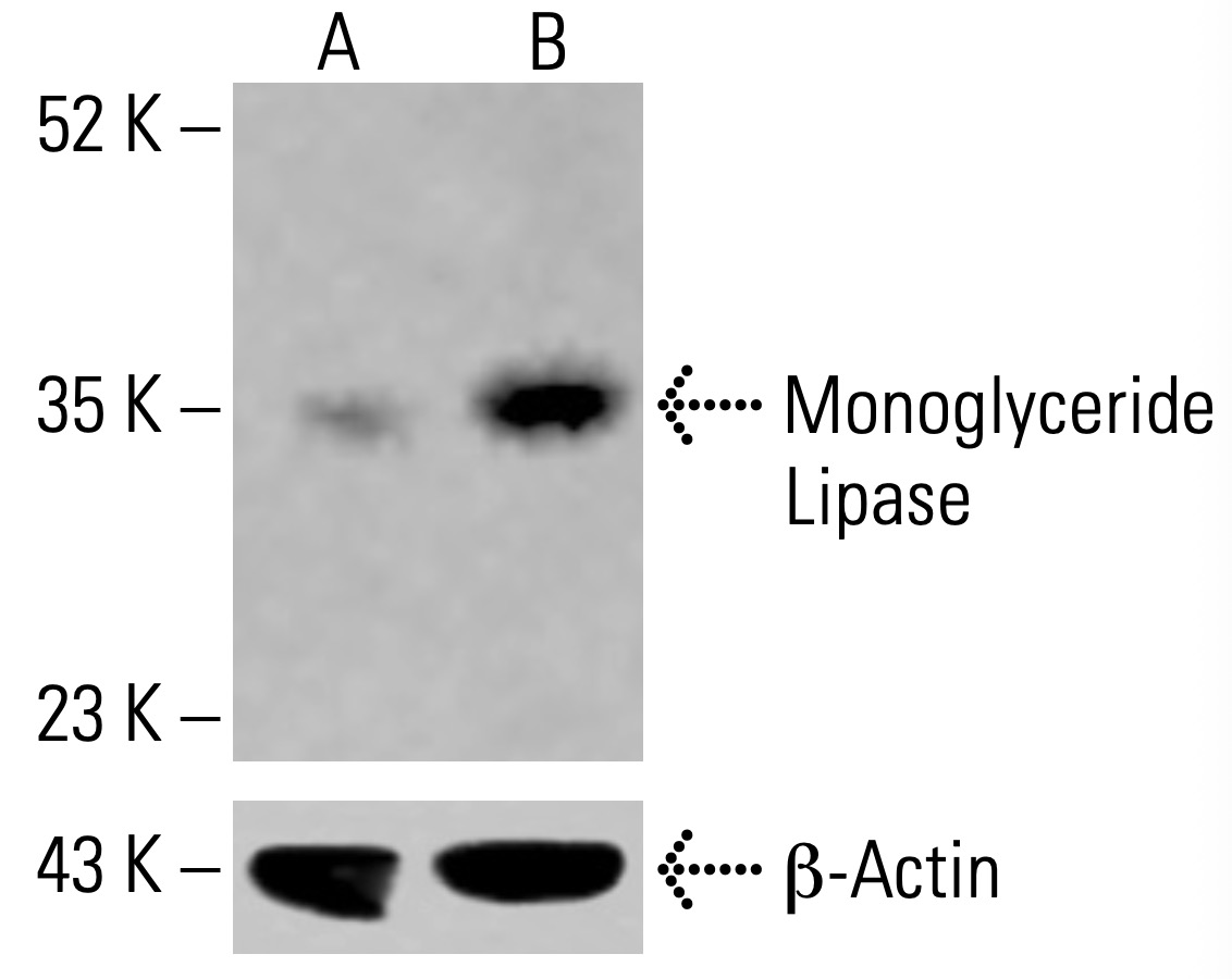 lipase 119u c Monoglyceride Lipase Antibody (C-11) | SCBT