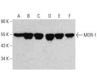 western blotting image from recommended MOR-1 (D-12) monoclonal antibody replacement. Image 385719