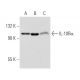 IL-10Rα (BD-9) sc-74144. Western blot analysis of IL-10Rα expression in non-transfected 293: sc-110760 (A), hu
