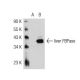 liver FBPase (N-13): sc-32430. Western blot analysis of liver FBPase expression in non-transfected: sc-117752 (A) and huma 