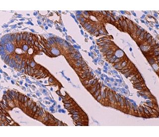 Cytokeratin 20 (G-20): sc-17113. Immunoperoxidase staining of formalin fixed, paraffin-embedded human small intestine tiss 