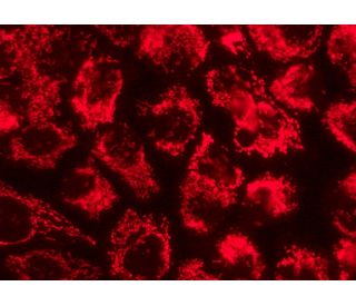 HSP 60 (K-19): sc-1722. Immunofluorescence staining of formalin-fixed A-431 cells showing mitochondrial localization. Dete 