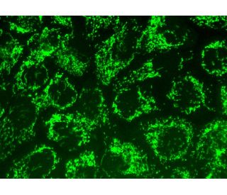 HSP 60 (K-19): sc-1722. Immunofluorescence staining of formalin-fixed A-431 cells showing mitochondrial localization. Dete 