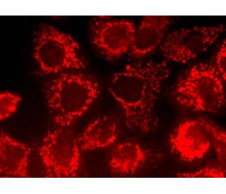 LRP130 (M-300): sc-66845. Immunofluorescence staining of formalin-fixed A-431 cells showing mitochondrial localization. De 
