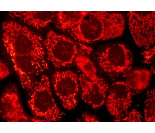 LRP130 (M-300): sc-66845. Immunofluorescence staining of formalin-fixed A-431 cells showing mitochondrial localization. De 