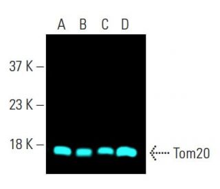 Tom20 (29): sc-136211. Fluorescent western blot analysis of Tom20 expression in Raji (A), CCRF-CEM (B), MDA-MB-231 (C) and 