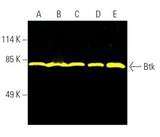 Btk (E-9): sc-28387. Fluorescent western blot analysis of Btk expression in U-698-M (A), MEG-01 (B), BJAB (C), NAMALWA (D) 