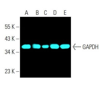 GAPDH (0411): sc-47724. Fluorescent western blot analysis of GAPDH expression in Jurkat (A), HeLa (B), K-562 (C), BJAB (D) 