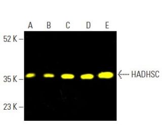 HADHSC (A-5): sc-376525. Fluorescent western blot analysis of HADHSC expression in Caki-1 (A), MCF7 (B), HEK293 (C), Hep G 