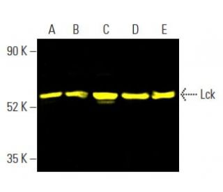 Lck (3A5): sc-433. Fluorescent western blot analysis of Lck expression in MOLT-4 (A), ALL-SIL (B), CCRF-CEM (C), Jurkat (D 