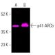 p41-ARCb (C-3): sc-137125. Fluorescent western blot analysis of p41-ARCb expression in U-698-M whole cell lysate (A) and h
