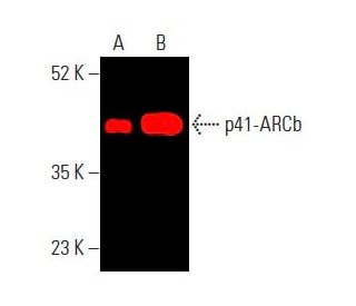 p41-ARCb (C-3): sc-137125. Near-Infrared western blot analysis of p41-ARCb expression in PC-3 whole cell lysate (A) and hu 