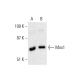 western blotting image from recommended Mox1 (C-10) monoclonal antibody replacement. Image 386260