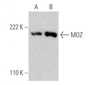 MOZ Antibody (4D8) - Western Blotting - Image 367978The Double Nickase Plasmid features a U6 promoter for sgRNA expression, a 20 nt targeting sequence, and a gRNA scaffold to guide Cas9n. It includes a CBh promoter for Cas9n (D10A) and puromycin resistance, GFP for transfection verification, and nuclear localization signals (NLS). The 2A peptide allows co-expression of Cas9n and Puro from a single promoter, enabling precise genome editing with reduced off-target effects.