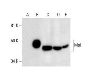 Mpi Antibody (E-4) - Western Blotting - Image 295935 