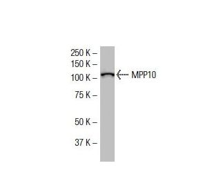 MPP10 Antibody (TJ-1) - Western Blotting - Image 33493 