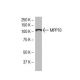 MPP10 Antibody (TJ-1) - Western Blotting - Image 33493 